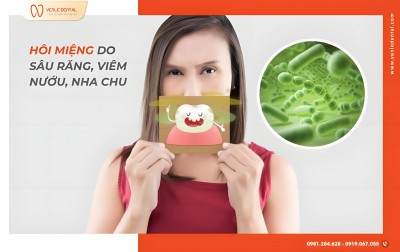 Hôi Miệng Do Sâu Răng – Viêm Nướu – Nha Chu