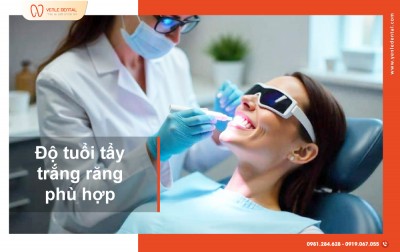 Độ tuổi tẩy trắng răng phù hợp – Khi nào là “đúng lúc”?