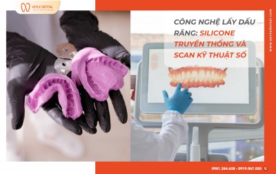 So sánh công nghệ lấy dấu răng: Lấy dấu truyền thống và lấy dấu kỹ thuật số 3D
