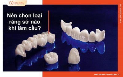 NÊN CHỌN LOẠI RĂNG SỨ NÀO KHI LÀM CẦU RĂNG?