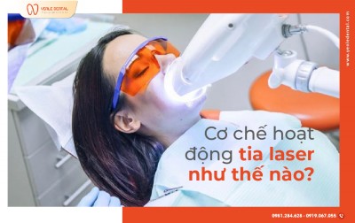 CƠ CHẾ HOẠT ĐỘNG TIA LASER NHƯ THẾ NÀO TRONG TẨY TRẮNG RĂNG?