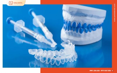 VỪA LÀM VIỆC, VỪA TẨY TRẮNG RĂNG