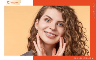 Niềng Răng Có Làm Thay Đổi Cấu Trúc Khuôn Mặt Không?