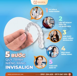 KHÁM PHÁ QUY TRÌNH NIỀNG RĂNG INVISALIGN – NỤ CƯỜI TỰ TIN CHO MỌI ĐIỂM NHÌN