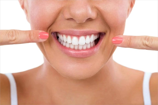 Răng đều hơn sau khi niềng
