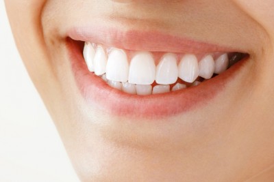 Những lý do nên lựa chọn răng sứ kim loại khi bọc sứ