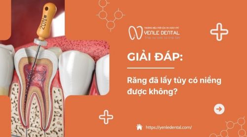 Bác sĩ tư vấn: Răng đã lấy tủy có niềng được không?