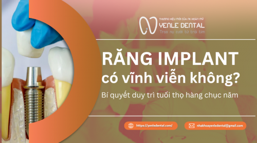 Trồng răng Implant có vĩnh viễn không? Bí quyết duy trì tuổi thọ hàng chục năm