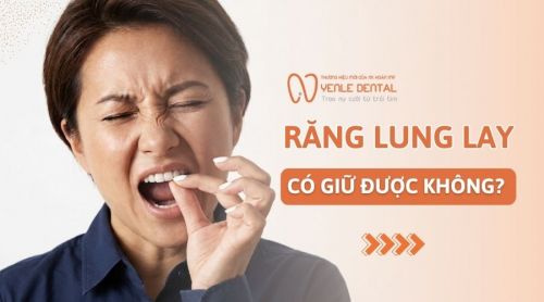 Răng lung lay có giữ được không? Điều trị như thế nào?