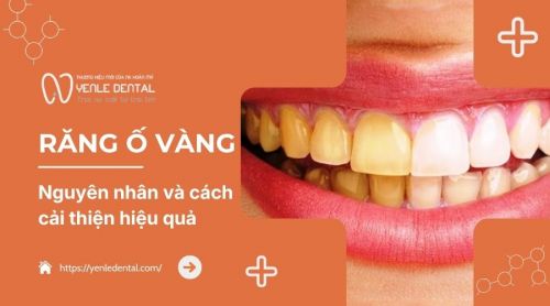 Vì sao răng ố vàng? Cách cải thiện răng trắng sáng