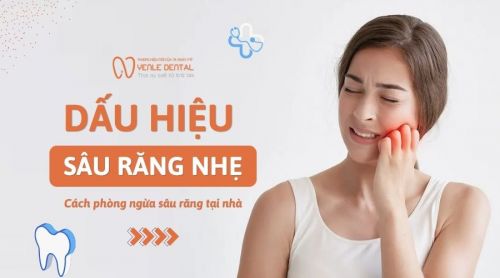 Dấu hiệu sâu răng nhẹ và cách phòng ngừa sâu răng tại nhà