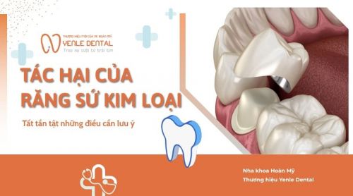 Tác hại của răng sứ kim loại và những điều cần biết