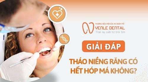 Giải đáp chi tiết: Tháo niềng răng có hết hóp má không?