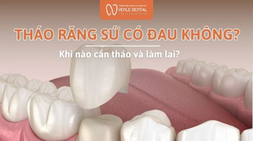 Tháo răng sứ có đau không? Khi nào cần tháo và làm lại?