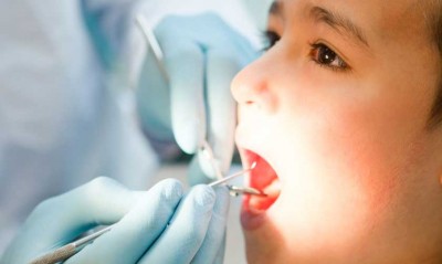 Trẻ Hay Ăn Ngọt – Có Nên Trám Răng Dự Phòng Không?