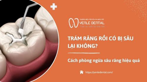 Trám răng rồi có bị sâu lại không? Cách phòng ngừa sâu răng