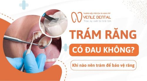 Trám răng có đau không? Khi nào nên trám để bảo vệ răng?