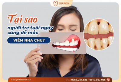 TẠI SAO NGƯỜI TRẺ TUỔI NGÀY CÀNG DỄ MẮC VIÊM NHA CHU?