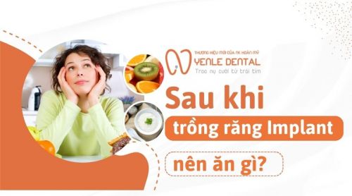 Sau khi trồng răng Implant nên ăn gì để nhanh phục hồi? 