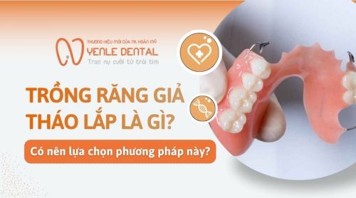 Trồng răng giả tháo lắp là gì? Có nên lựa chọn phương pháp này?