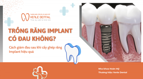 Trồng răng Implant có đau không? Cách giảm đau hiệu quả