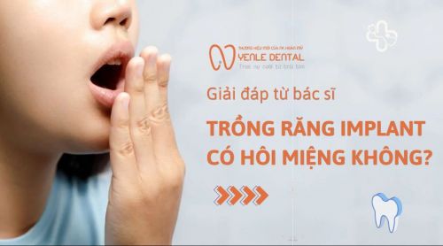 Giải đáp từ bác sĩ: Trồng răng Implant có hôi miệng không?