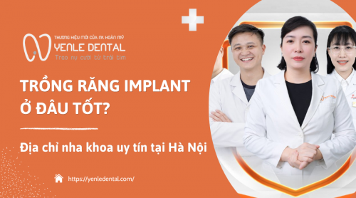 Trồng răng Implant ở đâu tốt? Địa chỉ nha khoa uy tín tại Hà Nội