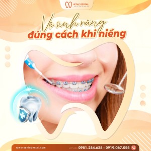 VỆ SINH RĂNG ĐÚNG CÁCH SAU KHI NIỀNG – BẢO VỆ NỤ CƯỜI HOÀN HẢO