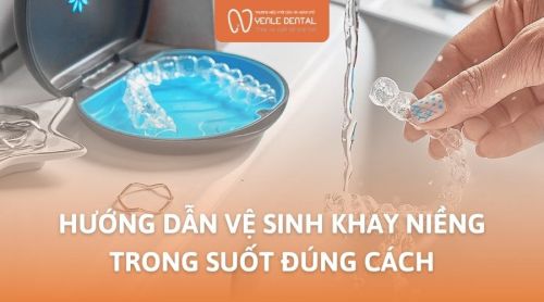 Hướng dẫn vệ sinh khay niềng trong suốt đúng cách