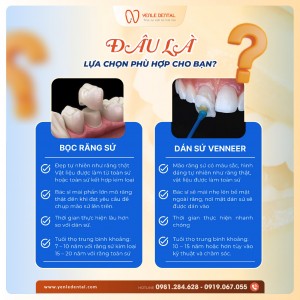BỌC RĂNG SỨ vs. DÁN SỨ VENEER – ĐÂU LÀ LỰA CHỌN PHÙ HỢP CHO BẠN?
