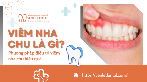 Viêm nha chu là gì? Phương pháp điều trị viêm nha chu hiệu quả