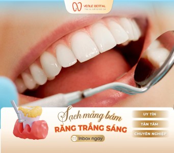 Tác dụng của việc lấy cao răng định kỳ là gì?