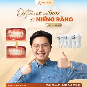 Độ Tuổi Lý Tưởng Để Niềng Răng - Giải Pháp Hoàn Hảo Cho Nụ Cười Hoàn Mỹ
