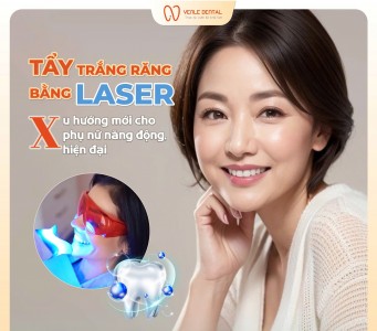 Tẩy trắng răng bằng công nghệ laser tại Yenle Dental